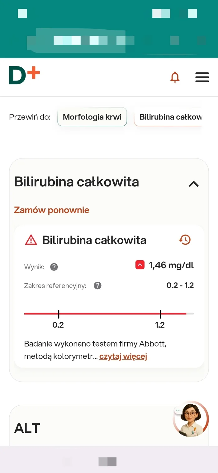 Wynik bilirubiny całkowitej przed konsultacją — 1,46 mg/dl, powyżej normy